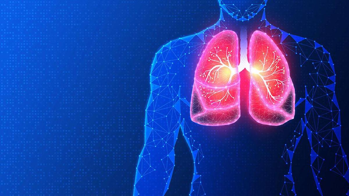 Lung Transplantation: Hurdles and Opportunities in India